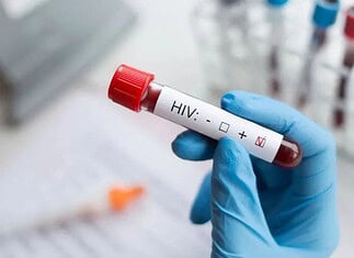 Salud Estatal impulsa acciones por el Día Mundial del VIH