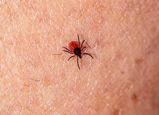 Confirman en Chihuahua un caso de tosferina, dengue y rickettsiosis en lo que va de 2026